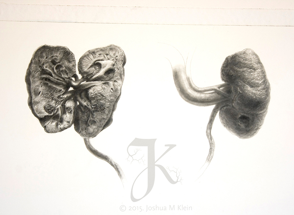 Medical Illustration of Cadaveric Kidneys in Carbon Dust